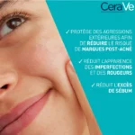 blemish patches 3 LG